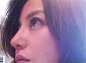鼻子高挺