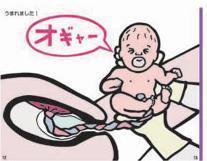 胎儿在医生和妈妈的努力下,终于生出来了!