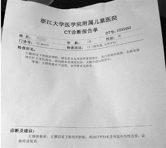 经浙大儿院诊断,小华额骨骨折。