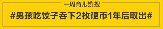 男孩吃饺子吞下2枚硬币1年后取出