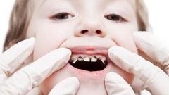 宝宝牙齿长黑斑应该怎么办？