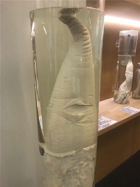 a) Sperm Whale 抹香鲸