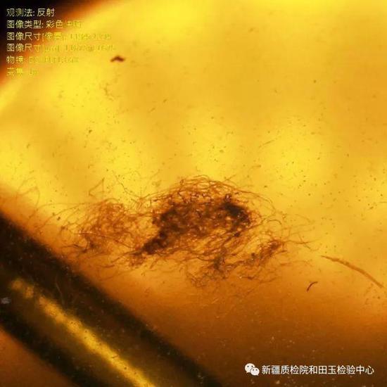 (上图)一堆丝线状的东西乱糟糟的缠在一起