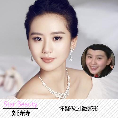 刘诗诗