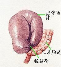 肠扭转