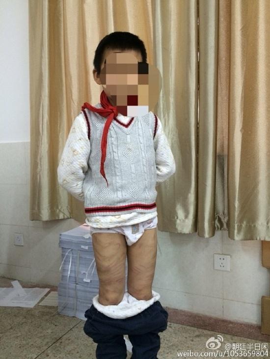 被打的孩子