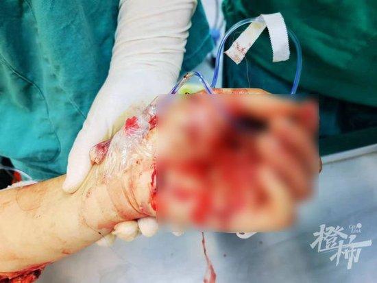 广东一女子被人连刺30多刀，嫌犯随后跳楼身亡！遇到这种飞来横祸，该怎样维权？
