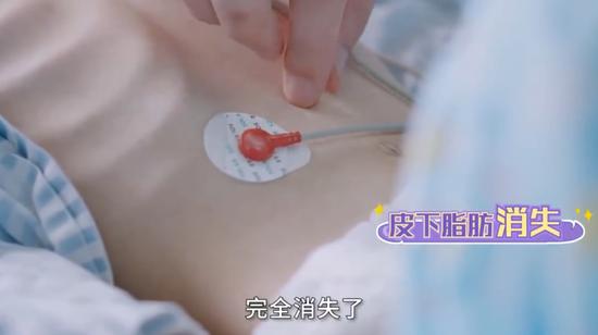 小玲在医院抢救时,皮下脂肪已消失(新闻视频截图)