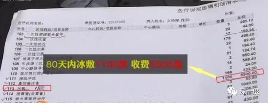 80天内冰敷1100次收费5500元