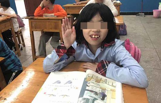 马英杰在特殊学校上课。受访者供图