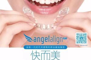 时代天使全新一代Angelalign Pro隐形矫治器加强型震撼上市