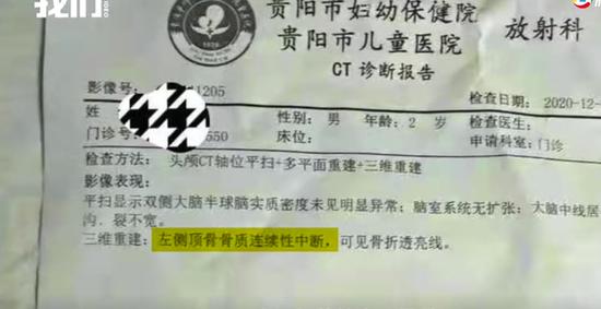 医院出具的CT诊断报告