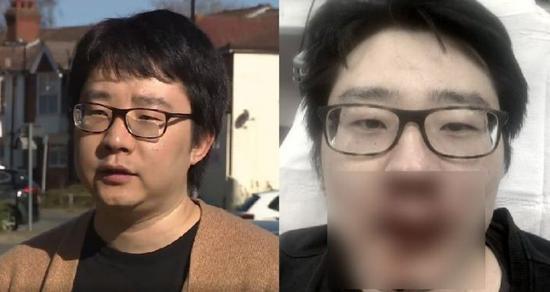 图左为王鹏3月1日接受采访的画面;图右为王鹏遇袭后受伤画面