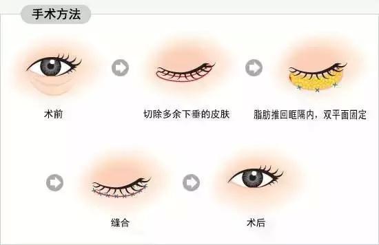 留疤