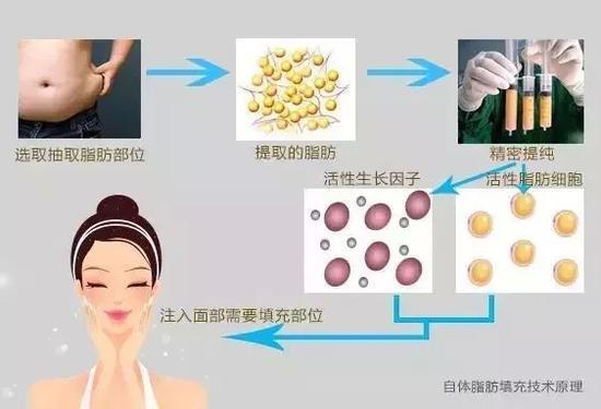 脂肪