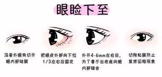 眼睑下至