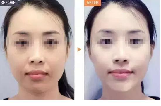 前后对比