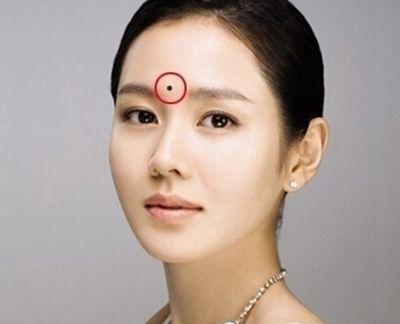 点痣