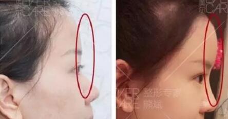 侧面看