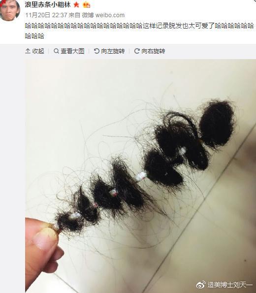 微博网友 @浪里赤条小粗林 关于朋友脱发记录的图片