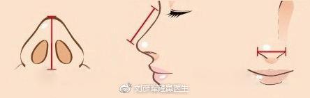做基础支架