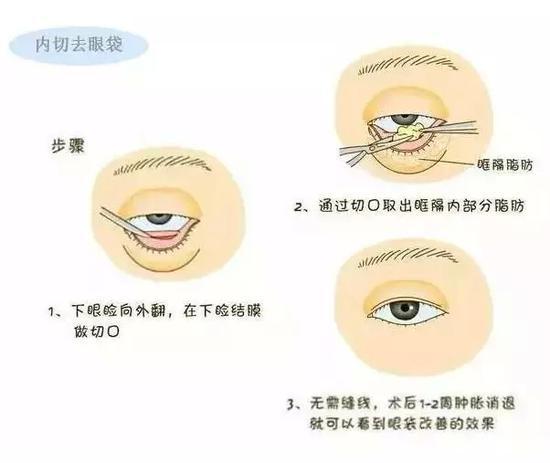 步骤