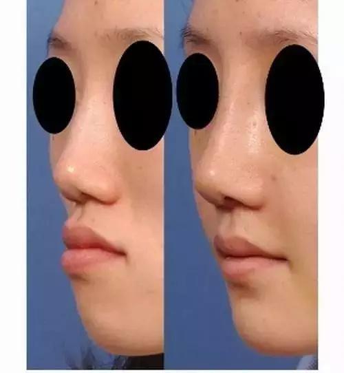 对面部影响