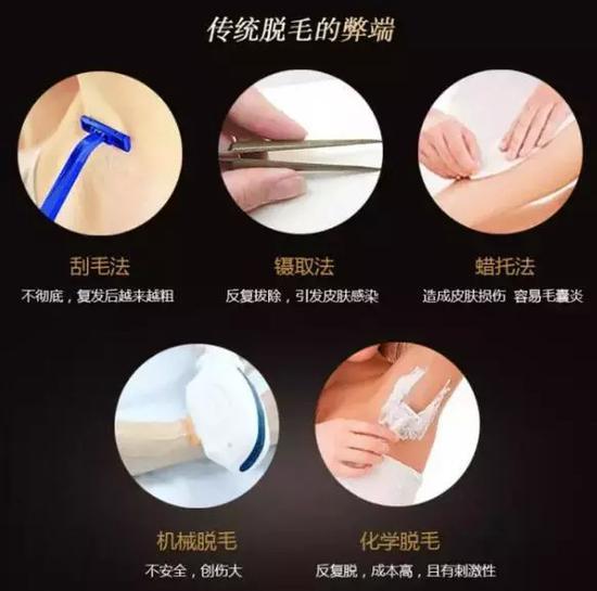 那些年,我们用过的脱毛方法