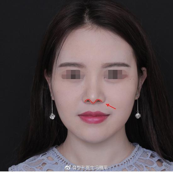 图示