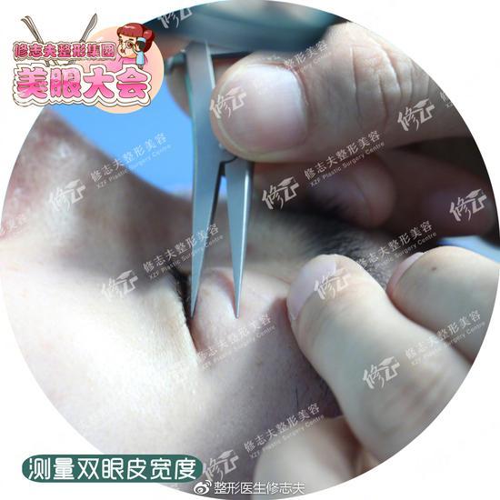 测量