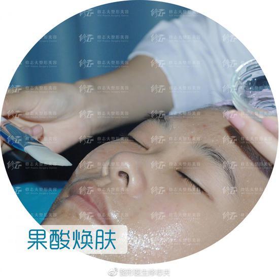 果酸焕肤