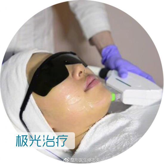 极光治疗