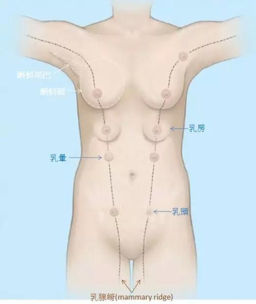 多数副乳存在于腋前或者腋下,而在腹部、腹股沟甚至大腿处虽也会发生。