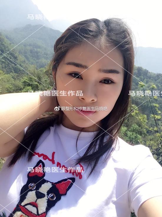 术后10个月