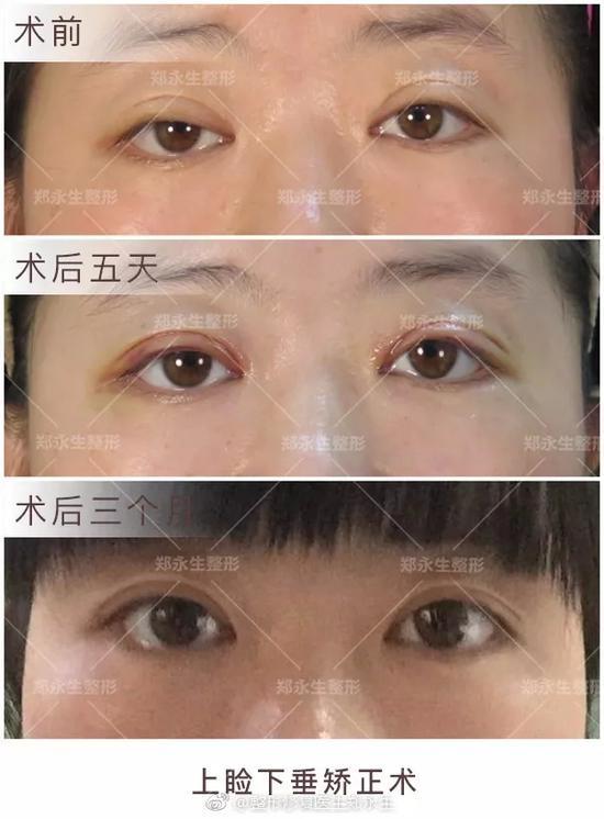 修复