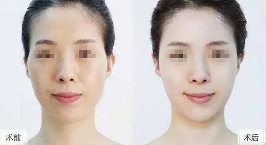 效果对比