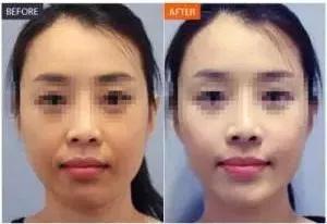 效果对比