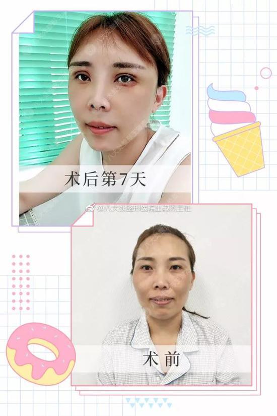对比