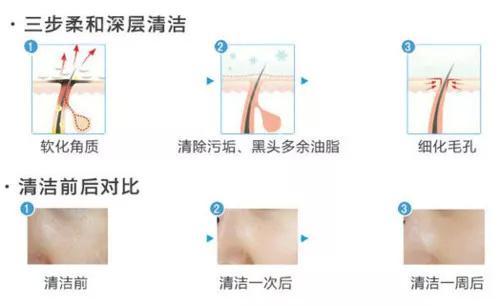 柔和清洁