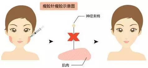 注射