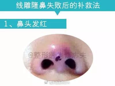 补救