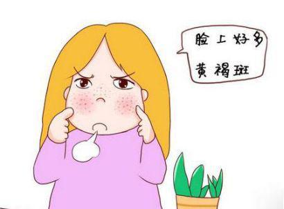 黄褐斑