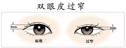 眼睛