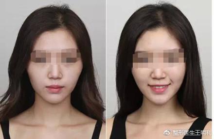 效果对比