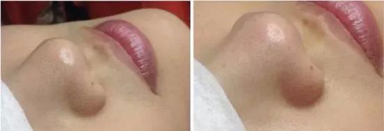 效果对比