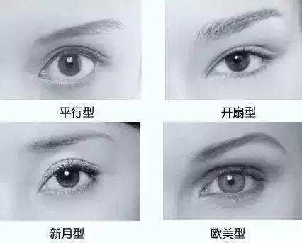 双眼皮形状