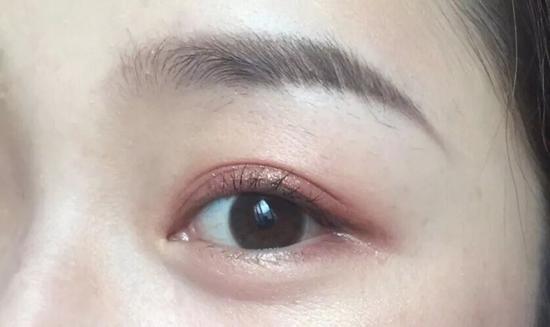图源 提莫队长