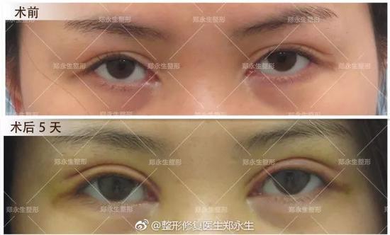 弧度不流畅