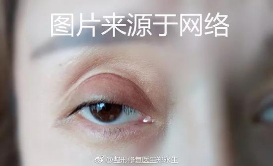 眼部形态异常