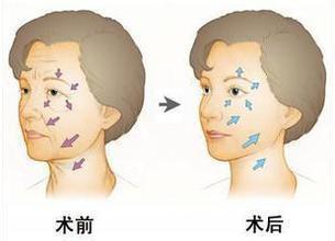 对比